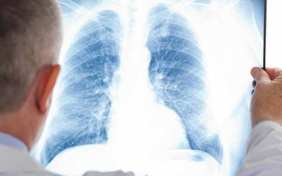 Rygestop og lungesygdomme: Sådan reducerer du risikoen for KOL